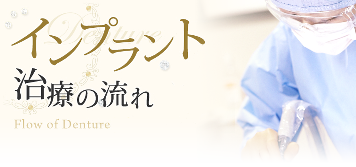 インプラント治療の流れについて