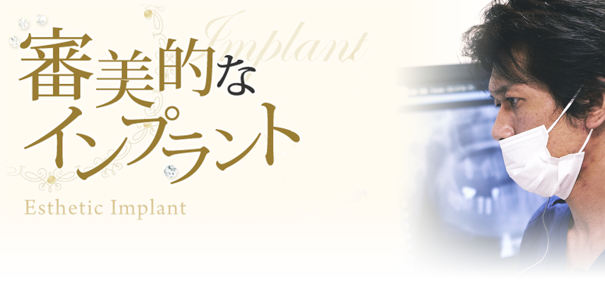 審美的なインプラントについて