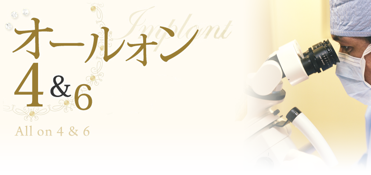 オールオン4＆6について