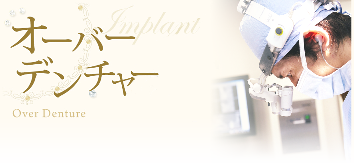 オーバーデンチャーについて
