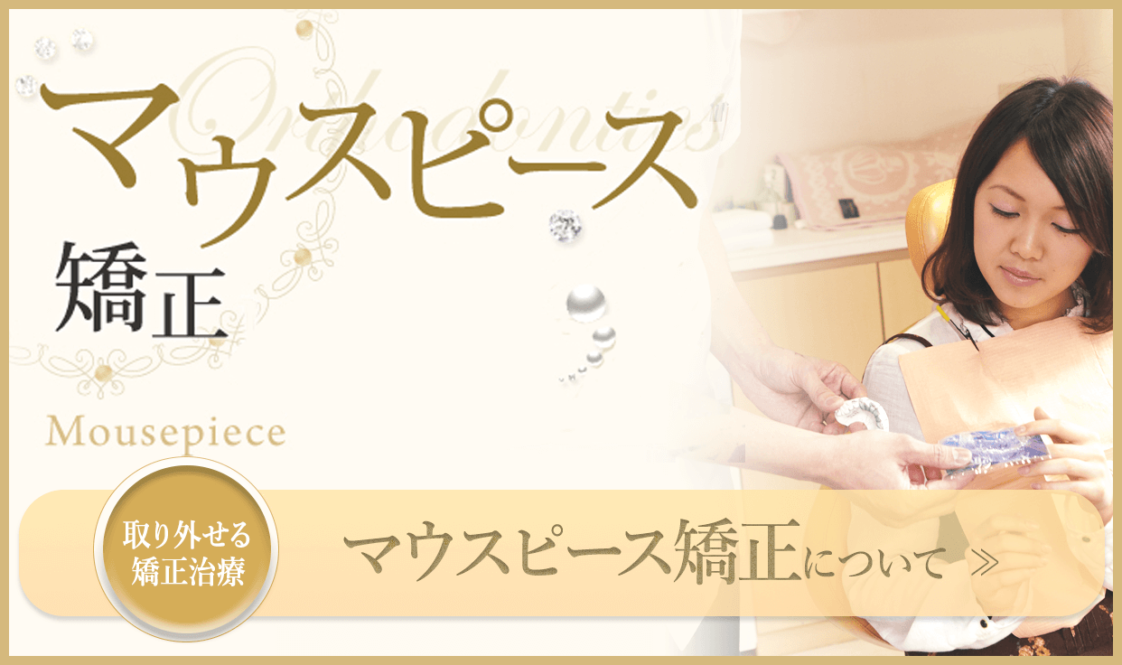 マウスピース矯正について